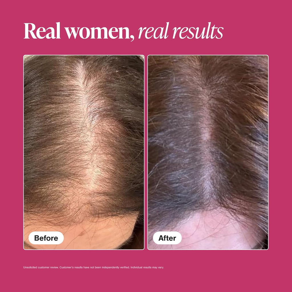 VIVISCAL, Hair Growth Supplement, 180 Tablets, 3 Month Supply.